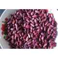 Purple Speckled Kidney Beans