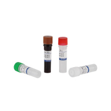 2019-nCov RT PCR test reagent kit (ORF1ab/N genes)