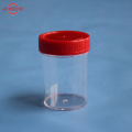 Medical stool sampling cup