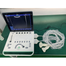 Cor de cor portátil de equipamentos médicos de equipamentos médicos do Doppler
