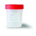 Siny Supply Hospital Disposable Medical Stool Sample cup