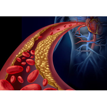 Système de moniteur cardiographique dynamique Holter ECG 24h / 24