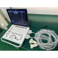 Color doppler ultrasound medical equipment labtop portable