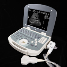 Laptop Digital Ultrasound Machine Scanner System for Clinic