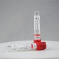 Anticoagulant vacuum blood collection test tube