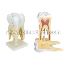 Human Teeth Model