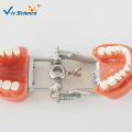 Dental Model Hard gum