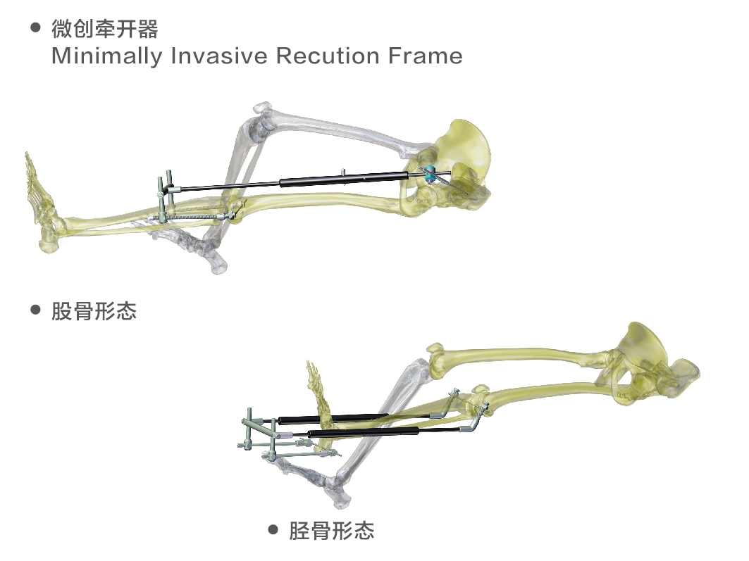 minimally invasive traction frame for limbs