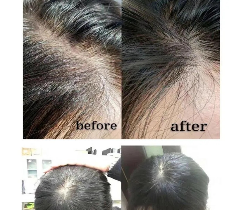 Innoaesthetics-Hair-Loss-Control-for-Man-to-Growth-Hair-Innoaesthetics-Hair-Loss-Control.webp (4) Innoaesthetics-Hair-Loss-Control-for-Man-to-Growth-Hair-Innoaesthetics-Hair-Loss-Control.webp (4)