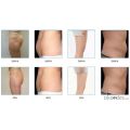 Choicy Cavitation RF Slimming System