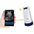 Convex Ultrasound Machine For Pregnancy Scanner