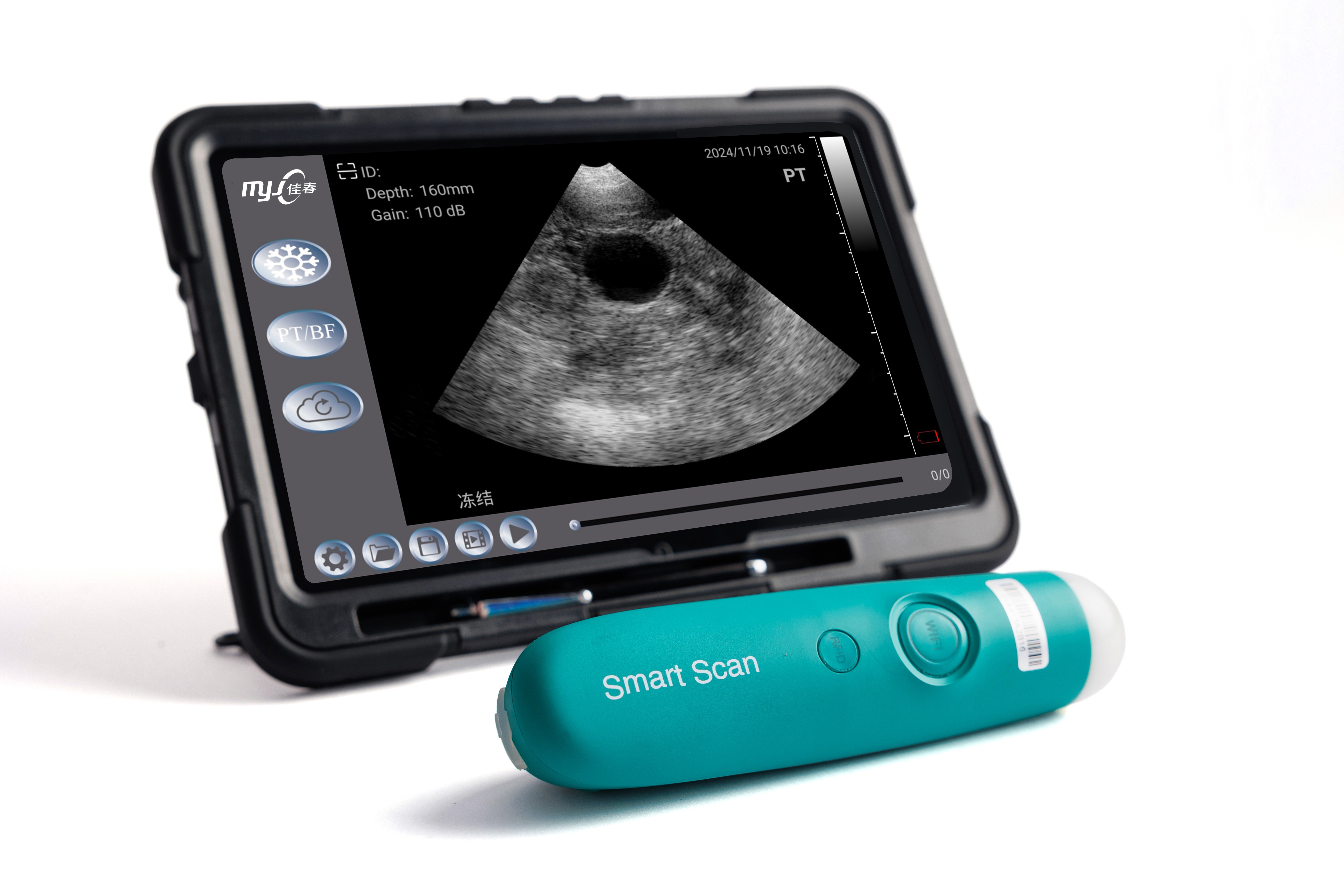 best handheld ultrasound best handheld ultrasound