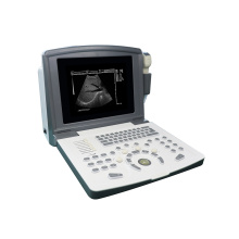 Scanner portátil de ultrassom preto e branco