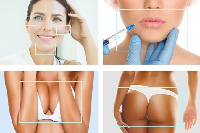 Hydrogel Buttock Injections