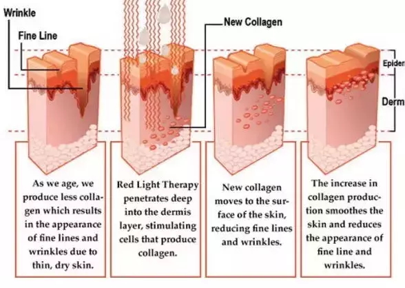 Led Therapy Light Application