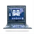 Laptop ultrasound equipment for poodle liver disease