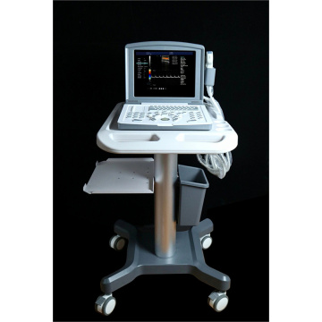 Portable Color Doppler Ultrasound Machine for Gynecology