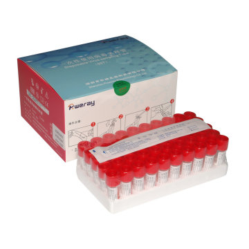 Kits de tubos de hisopo de muestreo de virus desechables PP 10ml