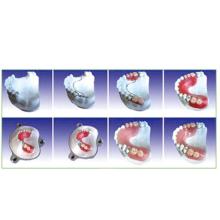 Modelo dental dos dentes de etapas de produção do articulador