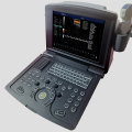 Tragbarer Farbdoppler -Ultraschallscanner