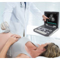 Scanner à ultrasons pour ordinateur portable numérique