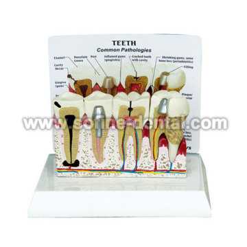 Teeth Model With Description Plate