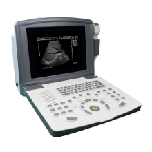 Portable Black and White Ultrasound Scanner for Gynecology