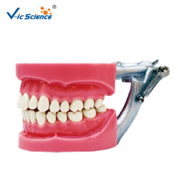 Dental Model Hard gum