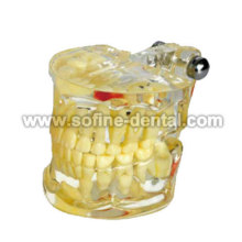 Dental modelo de enseñanza