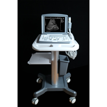 Portable B ultrasound scanner for abdomen