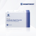 Superior HIV 1/2 Antibody Rapid Test Lateral Chromatography