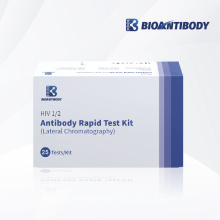 Anticuerpo superior del VIH 1/2 PRUEBA Rápida cromatografía lateral