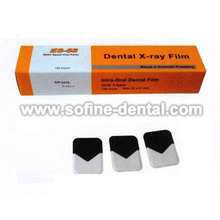 Dark 150Pcs X-Ray Unit