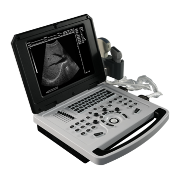 Li Battery Notebook B Ultrasound Scanner