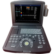 Portable Color Doppler Ultrasound Scanner