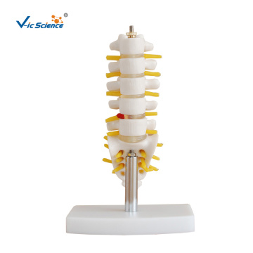 Mini Lumbar Vertebrae Anatomy Model