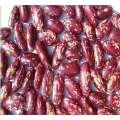 Purple Speckled Kidney Beans