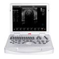 UW-L5 Laptop Color Doppler Ultrasound Scanner