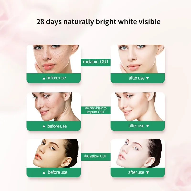 Whitening Effect 2 Whitening Effect 2