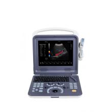 Scanner à ultrasons Doppler couleur cardiaque portable 4D