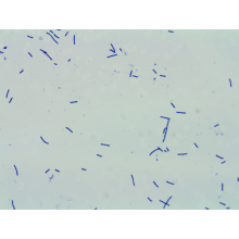 100 mil millones de CFU/g de polvo lactobacillus acidophilus