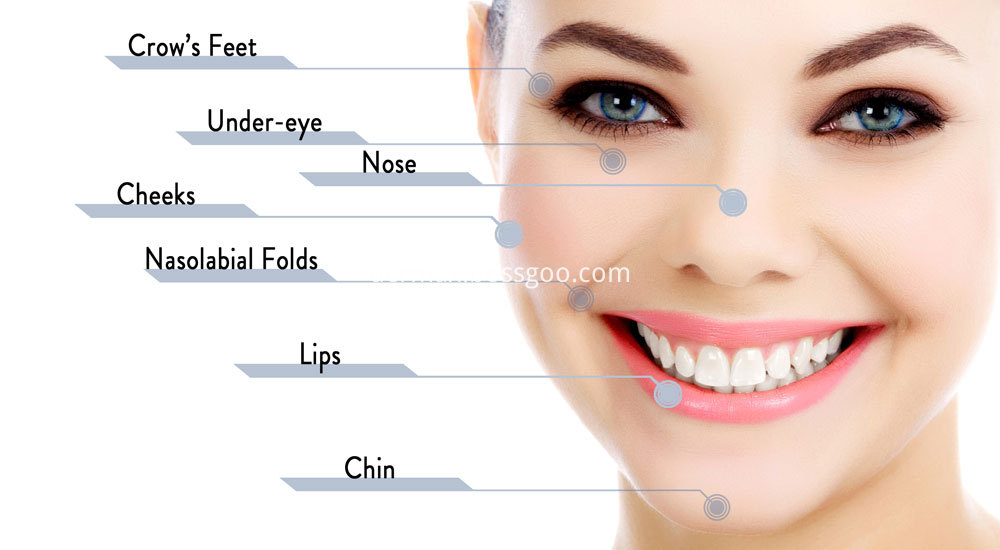 Button Enhancement Derm Filler