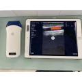 Sonostar Pocket Ultrasound Wireless Probe