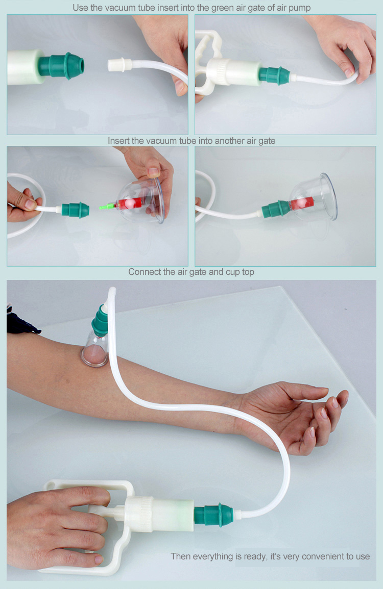 Best Seller Acupuncture Cupping Therapy Equipment