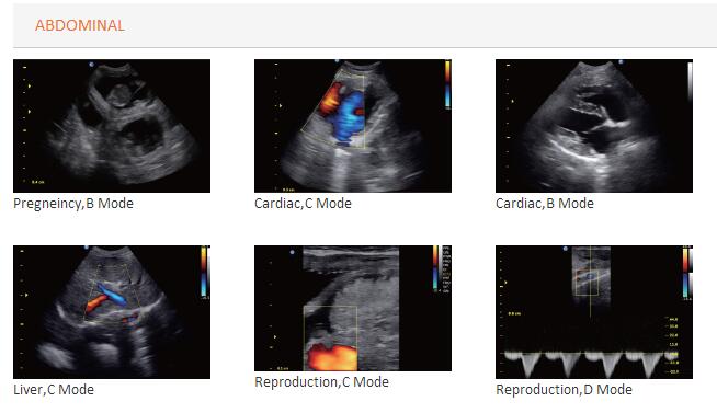 Ultrasound Color Scanner Doppler Laptop Portable (SC-ECO5)