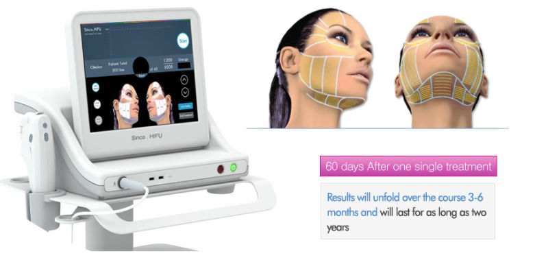 Hifu Portable Focused Ultrasound Beauty Machine for Skin Tightening