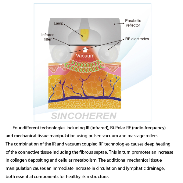 Newest Vacuum RF Cellulite Fat Removal Machine