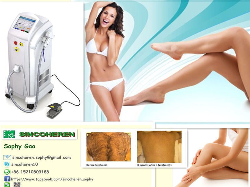 2013 New Technology 808nm Diode Laser Hair Removal Beauty Equipment