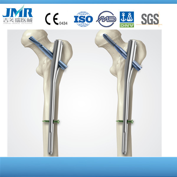 Orthopedic Implants Tibial Distal Lateral Locking Compression Plate Surgical Screws and Plates