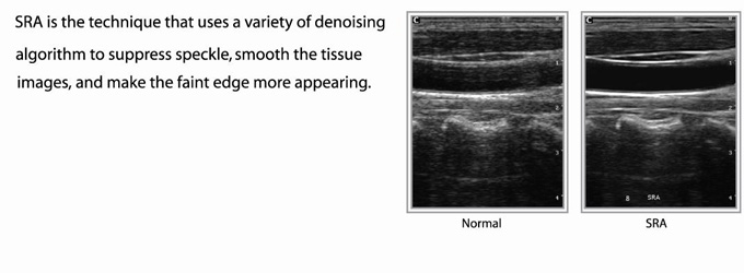 Ultrasound Scanner Color Doppler Laptop Portable (SC-Q5)